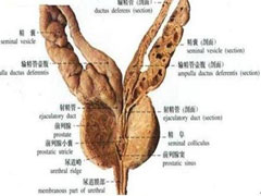 导致精囊炎的原因有哪些?